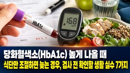 당화혈색소(HbA1c) 높게 나올 때 식단만 조절하면 늦는 경우, 검사 전 확인할 생활 실수 7가지